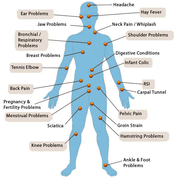 Bowen Therapy testimonials